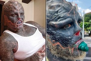Anthony Loffredo, the 'Black Alien' now wants to amputate his leg after cutting off fingers, ears, nose...