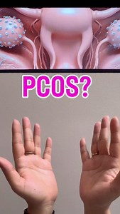 For PCOS ? 🌸 Practice Yoni Mudra 🌱 Follow ~ @shivangiyogastudio Follow ~ @shivangiyogastudio #yoga #pcos #mudra #yogini #viral #instadaily #yogateacher #instagram | yoga_withshivi