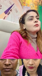 22K views · 401 reactions | Skin care - 9220729132 #Skincare #HealthySkin #BeautyRoutine #SkinCareEssentials | Nisha Lambha - Sparsh Beauty Care & Hair Treatment LLP | Facebook