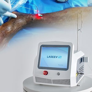 [Hot Item] 980nm Endovenous Vein Ablation Treatment Diode 1470 Nm Evlt Phlebectomy Varicous Veins Laser