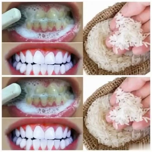 L'astuce infaillible pour blanchir vos dents en seulement 1 minute, que tout le monde peut faire à la maison. Vous devriez vite l'adopter, le résultat est complètement fou 😱😍👇 Voir le 1er commentaire | Mon monde à moi, c'est toi .