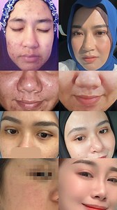 13K views · 139 reactions | Parut pada wajah memang boleh...