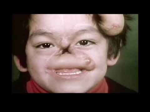 The Boy David : The Visit - ITV Documentary 1993