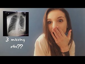 Pectus Carinatum?? | My Surgery Story