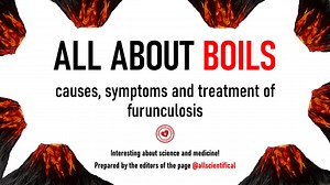 A furuncle is an acute purulent inflammation of the hair follicle,...