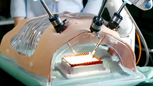 Lauterbach - Der Zukunft auf der Spur: Wie Roboter in Zukunft operieren (2/5)