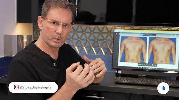 How to treat male puffy nipples gynecomastia