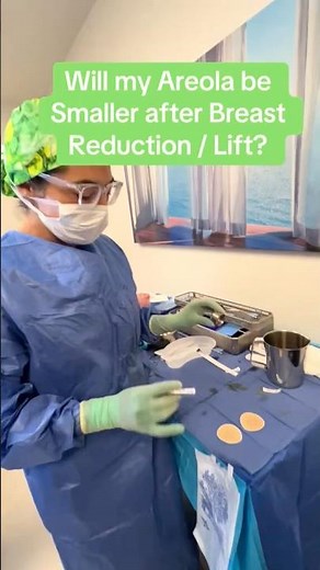 Areola size after breast reduction