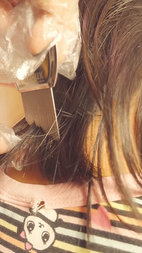 Jusqu’au dernier pou, tout a disparu! 😊 🔍 Commande ton peigne PikPoux maintenant par MP, paye par Juice et fais-toi livrer par la poste! 😊 #poux #cheveux #pouxdanscheveux #cheveuxnaturels #stoppoux #lentes #pikpoux #pikpouxmauritius | PikPoux Mauritius