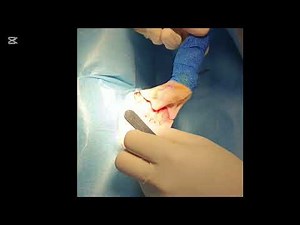 Cat Leg Amputation | Abandoned Stray’s Road to Recovery | maggot wound