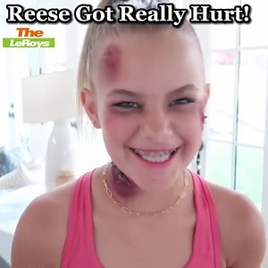 41 reactions · 4 comments | Reese Got Really Hurt凉#TheLeroys #Family #throwback | The LeRoy's | Facebook