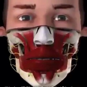 Maxillary sinus lift is a surgical procedure aims to increase the amount of bone in the posterior maxilla , in the area of the premolar and molar teeth, by lifting the lower Schneiderian membrane (sinus membrane) and placing a bone graft. When a tooth is lost the alveolar process begins to remodel. The vacant tooth socket collapses as it heals leaving an edentulous (toothless) area, termed a ridge. This collapse causes a loss in both height and width of the surrounding bone. In addition, when a 