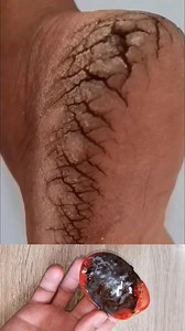 Get Rid Of Cracked Heels | Repair Cracked Heel At Home . . . #heels #heel #crackedheels #ridofcrackedheels #repaircrackedheels #feetcare #trendingreels #trending #viral #virals #fypシ゚ #explore #explorepage | YourBeauty Tv
