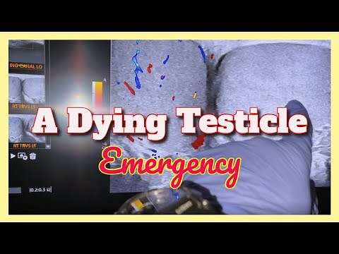 We Saved His Dying Testicle in 10 Seconds