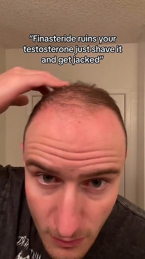 Finasteride buff #hair #hairtok #gym #gymtok #transformation #glowup #finasteride #motivation | Zeph Sanders