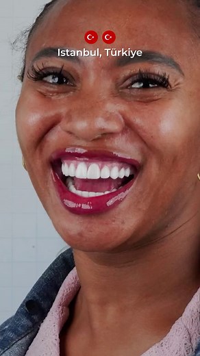 Dreaming of a brighter, perfectly shaped smile? At Hospitaprime in Istanbul, our expert cosmetic dentists craft ultra-thin laminate veneers that deliver a natural, long-lasting Hollywood smile — with zero pain and minimal tooth preparation. ✨ Why patients choose our veneers: ✔ Natural, translucent look ✔ Durable & stain-resistant ✔ Minimal shaving of the teeth ✔ Designed uniquely for your face and smile ✔ VIP service: hotel, private transfers & translator 📍 Istanbul, Turkey Ready for your smile