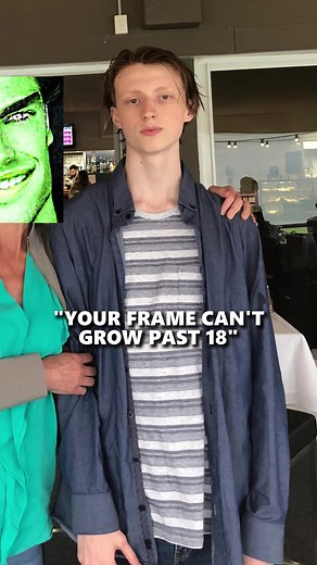 Can Your Frame Grow Past 18? Answering Growth & Androgenic Frame Questions
