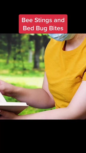 #lifeprotips #foryou #beesting #bedbugs #wasps #bee #sting
