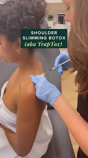Thanks to Kim Kardashian, the word on Trap Botox has spread like 🔥BUT while TrapTox is a new trend, it isn’t new. In fact, this fab treatment has been around and winning the benefits game for years. Keep reading ⤵️ TrapTox involves injecting Botox into the Trapezius muscles (the large muscle that starts at the base of your neck and extends across your shoulders to the middle of your back) to relax and slim the muscles. Consequently, this reduces the look of shoulder bulk in the trap area, causi