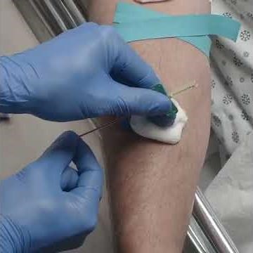 Drawing blood with a butterfly needle