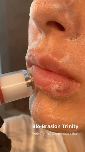 Discover the power of Bio-Brasion Trinity’s wet/dry microdermabrasion! Application delivers rapid improvement in skin texture, clarity, and hydration whether as a stand alone service or as a base prior to other treatments. With a selection of five diamond tips of varying grits, you can customize your service to perfectly meet your clients’ needs. | Bio-Therapeutic