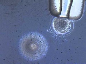 Sperm And Egg Footage