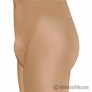 Mons Pubis Reduction Atlanta | Mons Pubis Enlargement | Dr. Miklos