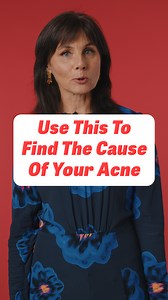 Pay attention to where acne shows up on your face. You can search acne face chart and you can see what organ correlates with it. Lots of women tend to get acne on the chin, especially right before or during the period. This is usually due to something being off balance in the reproductive system, like having too much estrogen. There are many different ways to support the organ that may be struggling, I highly recommend you do your own research and in the future I will release more videos on how 