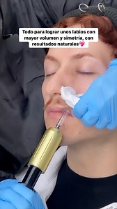 2K views · 19 reactions | El Hyaluron pen es una alternativa...