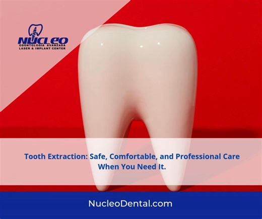 Tooth extraction is a common dental procedure performed to remove damaged, decayed, or problematic teeth that can not be restored. Our expert team ensures a safe and comfortable process, minimizing discomfort and promoting optimal healing. If you’re experiencing pain or dental issues, consult us to determine the best treatment plan tailored to your needs. . 📱🦷 915 308 0101 nucleodental.com . #NucleoDental #dentalclinicnearme #dentaltourismmexico #dentalimplantsjuarez #bestdentalserviceintown #