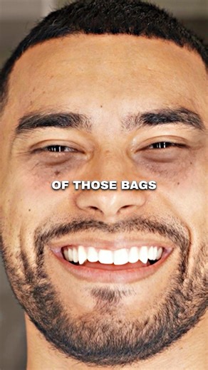 Get Rid Of Eye Bags OVERNIGHT🤫Jose Zuniga explains how to remove eye bags or dark eye circles naturally at home overnight! Add this glow up secret to your daily skincare routine and become attractive! 🔥👀#josezuniga | Men Style Community