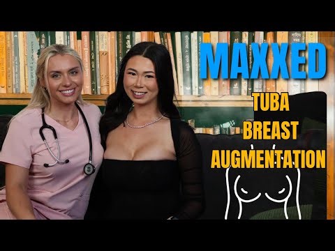 Ep 7. I Got a 600cc Boob Job Through My Belly Button! (No Scars) with Kara