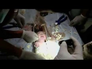 Newborn Baby Saved From Toilet Pipe In China