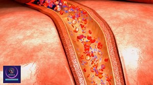 2.5K views · 15 reactions | Control Your Diabetes! How Diabetes is Formed Into Your Body #diabetes #diabetesawareness #medical #animation | Medical Animation Media | Facebook