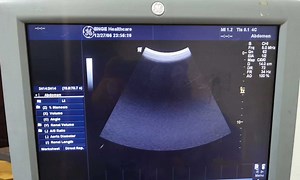 [Hot Item] 15" LCD Monitor Fw15lxg for Ge Logiq P5