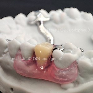 [Hot Item] Close Adaptation in Mouth Removable Valplast Flexible Dentures Removable