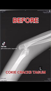 1.6K views · 25 reactions | Unlock Pain-Free Movement and Renewed...