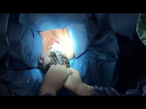 Parto natural en directo _ Nacimiento de un bebé