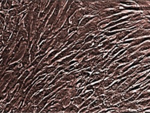 hMSC – Human Mesenchymal Stem Cells | Lonza