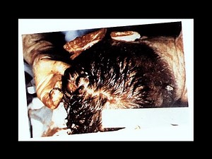 The JFK Autopsy Photos (HD)