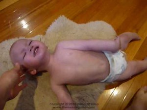 Reflex anoxic seizure 11-3-10