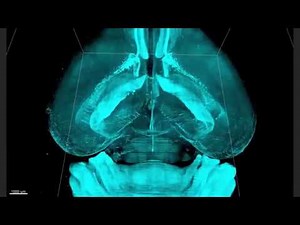 3D-Reconstructed Whole-Brain Images