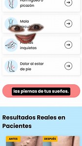 Las enfermedades de las venas afectan a 30 millones de estadounidenses. Los síntomas incluyen: ❌ Dolor ❌ Incomodidad ❌ Hinchazón ❌ Calambres ❌ Picazón en las piernas Afortunadamente, en Metro Vein Centers el tratamiento es fácil y está cubierto por la mayoría de los seguros. | Metro Vein Centers | Facebook