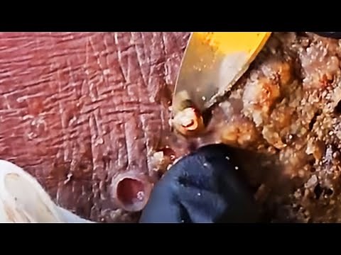 Digging Jiggers with the Rise Up Society in Kenya, Africa