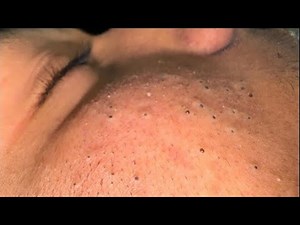 Maya Morning Skincare Routine (For Clear Acne-Free Glowing Skin)