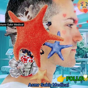 41K views · 327 reactions | Infected Swimmer Ear | Deep Cleaning ASMR Animation ASMR Removal Maggot Worm #Animation #Makeup #remove #Maggots #Treatment makeupanimation #asmrgaming #skincare #asmrtapping #asmrmake #Maggots #asmrsakirmedical | Asmr Sakir Medical | Facebook