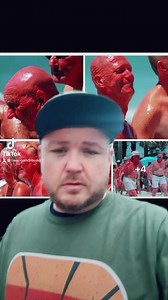 1.3K views · 33 reactions | Third-degree burns for the win #roundsview | Twang and Round | Facebook