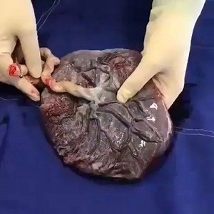 Placenta. . Siga-nos: Instagram.com/anatomia.love | Anatomia/Fisiologia Humana