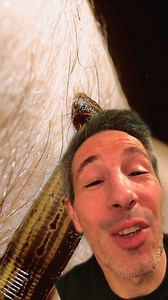 Les sangsues qui soignent, vous connaissez ? #sante #sangsue | Dans Ton Corps