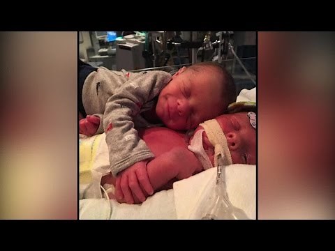 Photo of newborn twins hugging goes viral